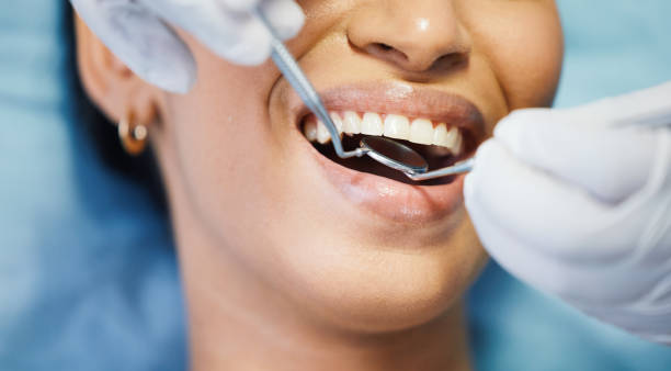 Best Knocked-Out Tooth (Avulsed Tooth) Treatment in Dexter, MO